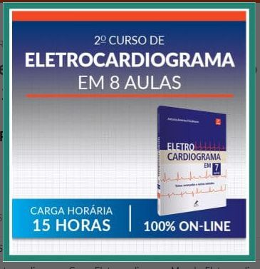 Curso de Eletrocardiograma (2º Curso em 8 Aulas) Manole 2021
